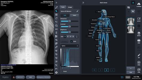 voyance medical.